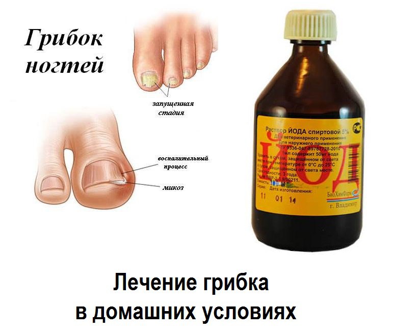 Для чего надо мазать ногти йодом Для чего надо мазать ногти йодом