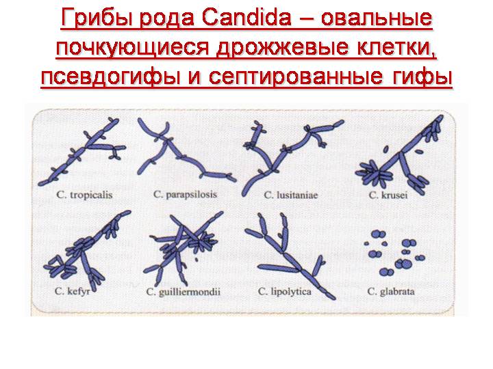 Клиническая картина кандидоза