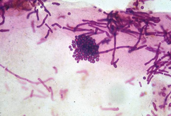 грибок Malassezia furfur