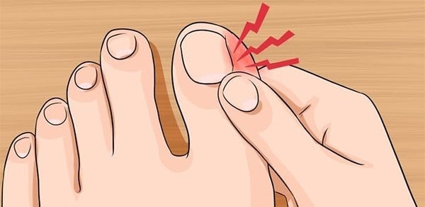 причины болезненности ногтя