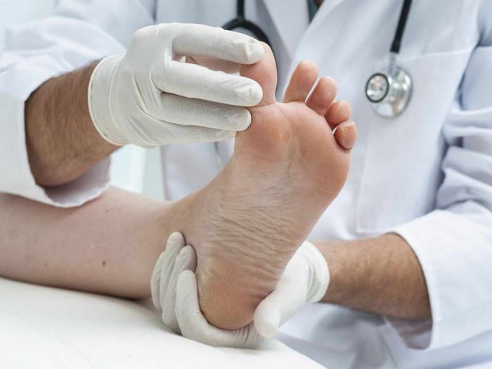 Контактный дерматит на ногах лечение мази thumbnail