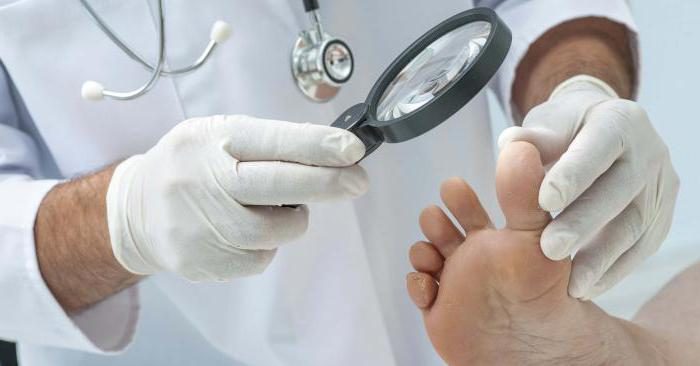 принципы лечения заболеваний ногтей